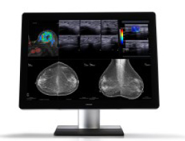 Monitores para radiología